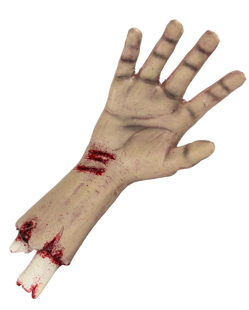 Abgetrennte Obduktions Hand mit Unterarm
