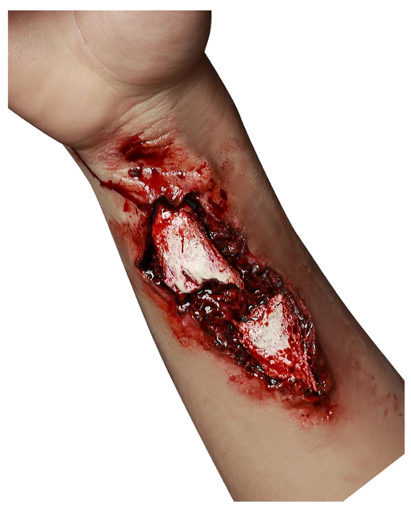 Gebrochener Arm FX Latexwunde
