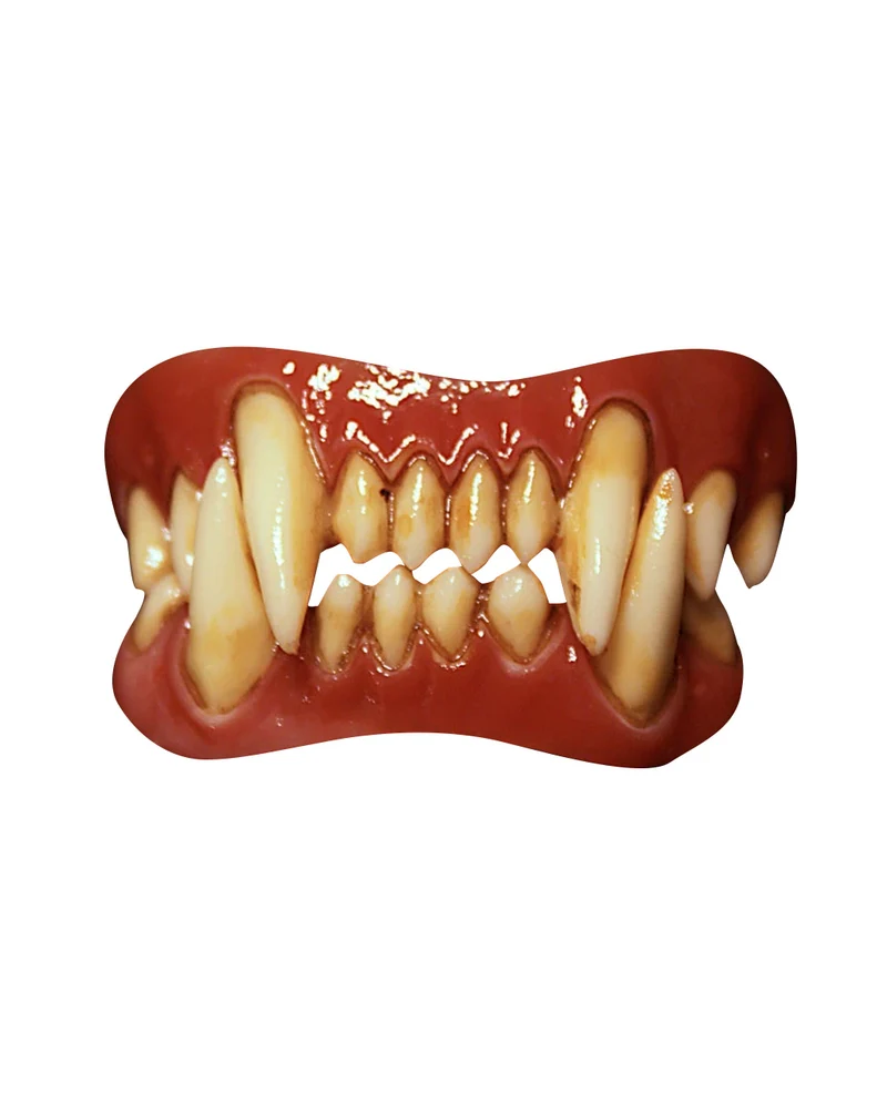 Dental FX Veneers Werwolf Zähne